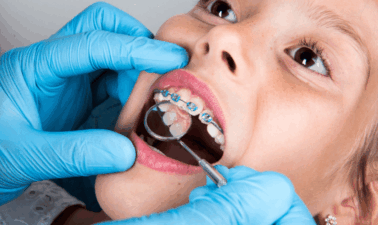 Orthodontic Treatment